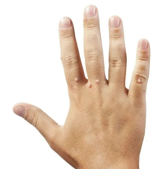 640.webp.jpg